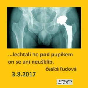 Opony 180 – 2017-08-03 Totálna endoprotéza a iné